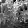 a SEM image of corallites