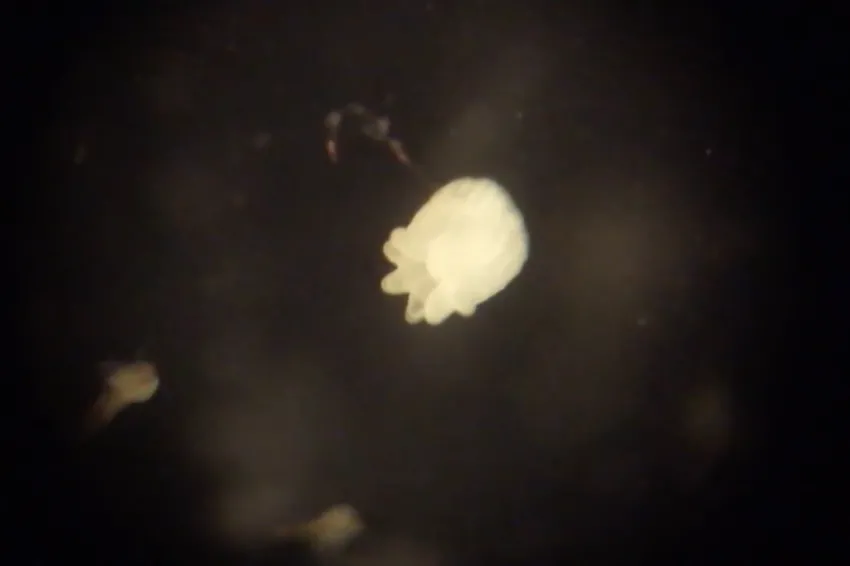 A screenshot from the video showing a small anemone through a microscope.