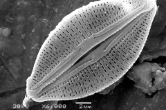a magnified image of a diatom
