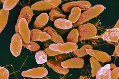 a colored micrograph of microbes