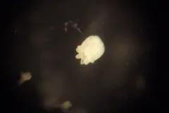 A screenshot from the video showing a small anemone through a microscope. 