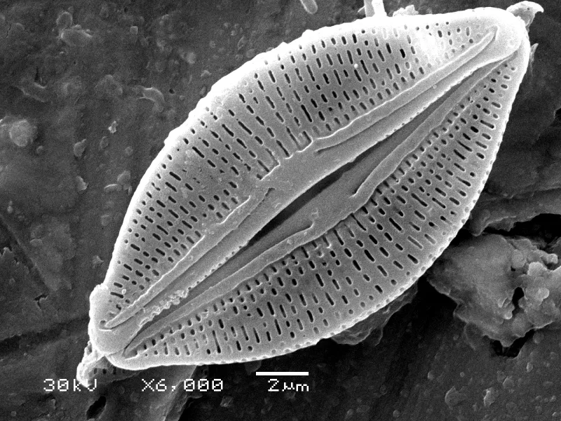a magnified image of a diatom