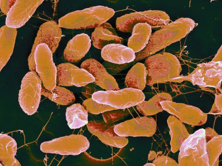a colored micrograph of microbes