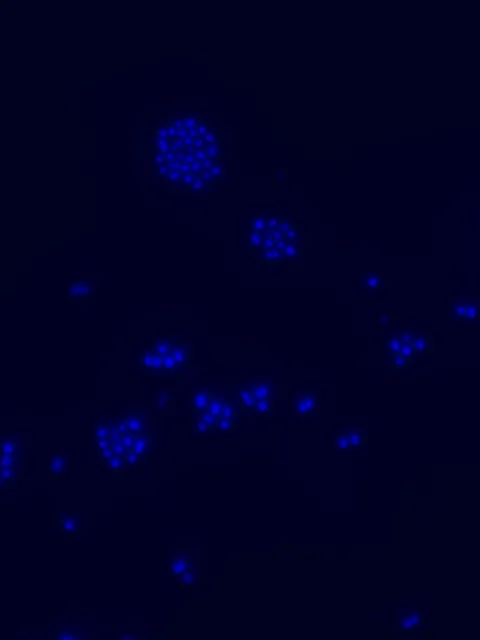 Black background with bright blue clusters of dots.