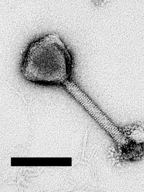 Black and white image of a magnified cyanophage.