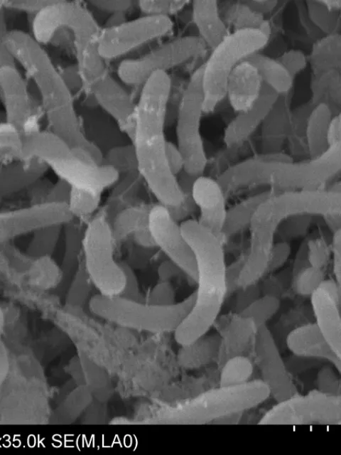 Black and white magnified image of SAR11.